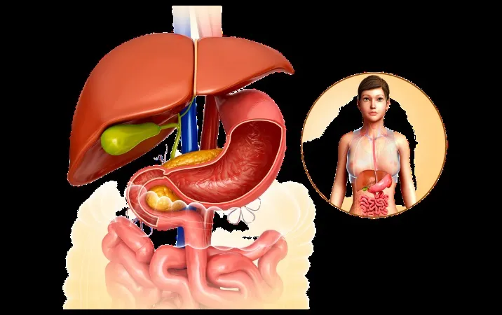 Cardiolis